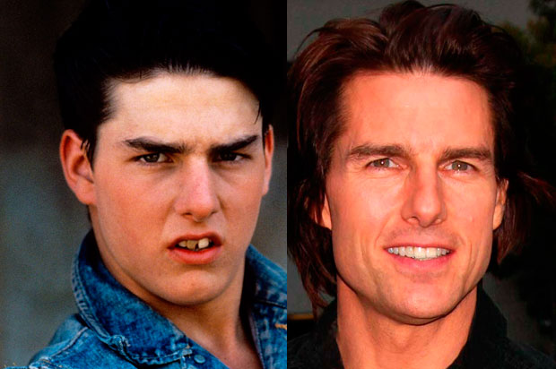 10 celebs who used to have horrible smiles (Photo) - Canada Journal