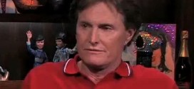 Bruce jenner facelift surgery