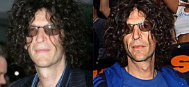 Howard Stern admits to plastic surgery