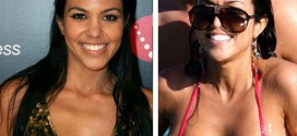 Kourtney Kardashian breast augmentation : Star Regret Plastic Surgery