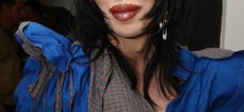 pete burns sues lip surgery