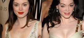 Rose mcgowan facelift, eyelids, fillers in lips and cheeks