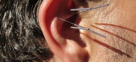 Ear acupuncture could help lose weight, Study