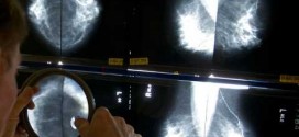 Cancer death rates decline in US