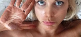 Ashley James suffers major fake tan fail