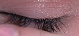 Florida women claim COVERGIRL mascara made eyelashes fall out