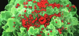 US : Death Rate From HIV-AIDS Continues to Drop