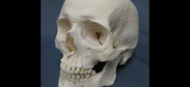 RCMP : Skull mystery emerges from garage in Hinton