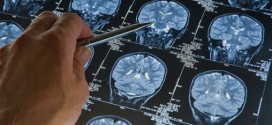 Feds announce funding for dementia research, Report