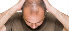 Male-Pattern Baldness Linked to Aggressive Prostate Cancer, Study