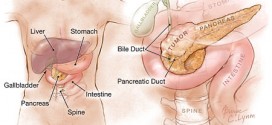 Researchers Detect Early Sign of Pancreatic Cancer