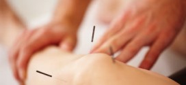 Acupuncture is 'not beneficial for knee pain', Study Reports