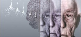 Memory loss associated with Alzheimer’s reversed for first time, Study