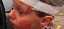 Six-Year-Old boy attacked on school bus now recovering