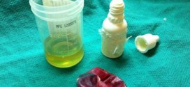 A vial of urine hidden in rectum (Photo)