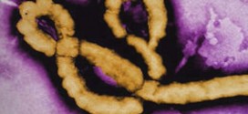 Possible case of Ebola in Quebec, deemed low-risk