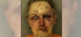 Rape suspect beaten by boyfriend of victim (Photo)