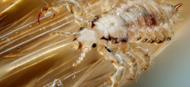 Girl Dies During Head Lice Treatment, say police