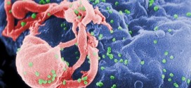 New HIV strain detected in Cuba, Develops Into AIDS Very Fast