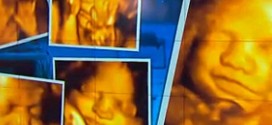 3-D Ultrasounds Could Be Dangerous, FDA : Study