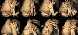 Smoking And Pregnancy : Ultrasound images reveal what smoking does to unborn babies