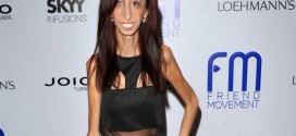 World's Ugliest Woman : Lizzie Velasquez Proves Her Haters Wrong By Releasing A Documentary! (Trailer)