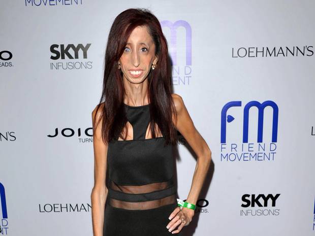 World S Ugliest Woman Lizzie Velasquez Proves Her Haters Wrong By Releasing A Documentary