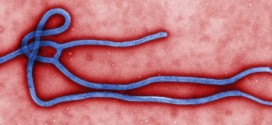 Ontario patient with Ebola-like Symptoms Tests Negative