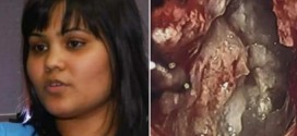 Yamini Karanam : Woman's brain tumor turns out to be "evil twin" (Video)