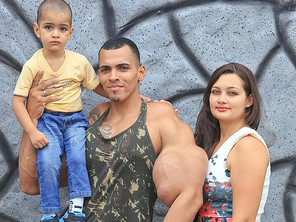 Bodybuilder Injections Arms Romario Dos Santos Alves risks his life by injecting oil into his biceps