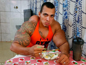 Bodybuilder Injections Arms Romario Dos Santos Alves risks his life by injecting oil into his biceps