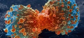 Canadian cancer cases will increase 40 per cent by 2030