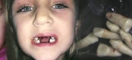 Dentist Accused Of Child Abuse : Took Out Teeth for No Reason