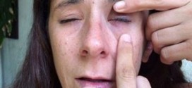 Woman glues eye shut after Visine, super glue mixup (Video)