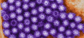 California: Norovirus - aka Winter Vomiting Disease - Is on the Rise, officials warn