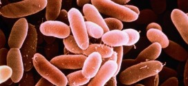 Seven hospitalized in Five provinces affected by Listeria outbreak, Ministry of Health says