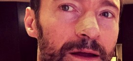 Hugh Jackman: X-Men star has another skin cancer growth removed