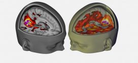 First scans show how LSD affects the brain, Study