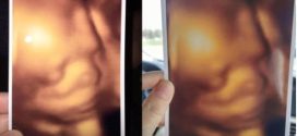 Expecting mothers say Pickering clinic gave them identical 3D ultrasound images