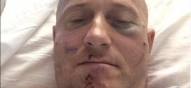 Richard Ojeda: Candidate for WV State Senate injured in attack