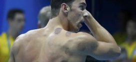 Michael Phelps Leads the Rio Cupping Craze (Photo)