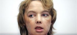 Isabelle Dinoire: Woman who received first face transplant dies at 49