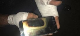 Amarjit Mann Says Galaxy S7 Exploded In His Hand