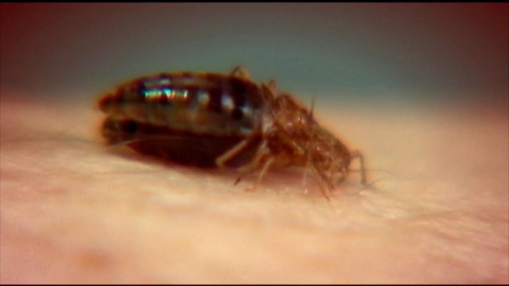 'Super' bedbugs are becoming resistant to treatment, says new research ...