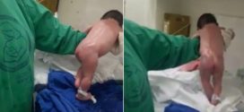 Baby shocks medical staff by walking minutes after birth (Video)